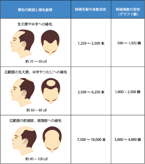 切らない自毛植毛《MIRAI法》東京 新宿 院 費用について
